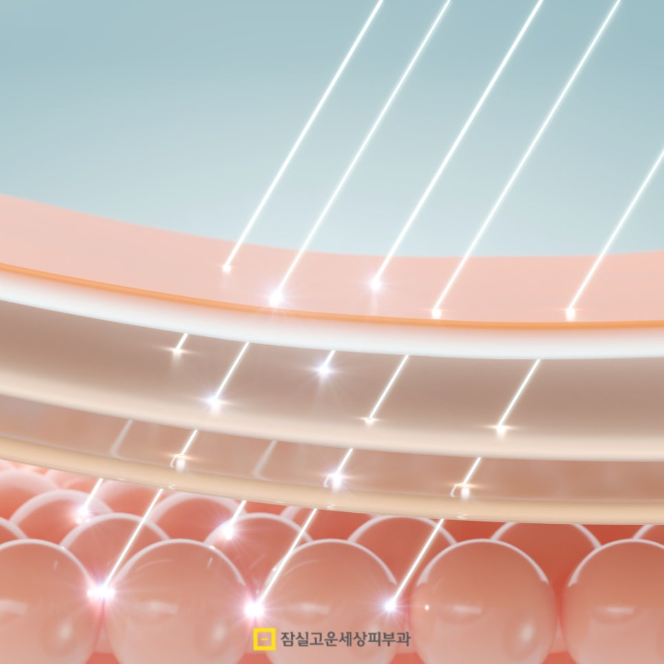 환절기 예민하고 건조한 피부에 효과적인 시술 관련 이미지 6