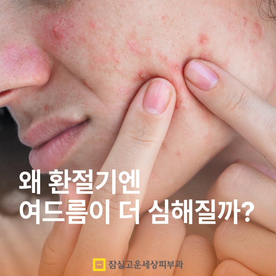 왜 환절기엔 여드름이 더 심해질까요? 관련 이미지 1