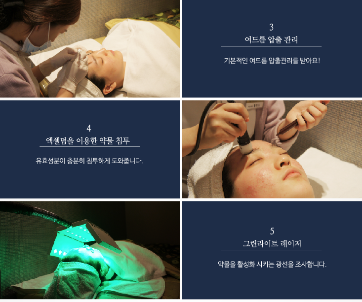 잠실에서만 만나보실 수 있는 특별한 핌클케어 프로그램! (잠실고운세상/여드름치료/핌클케어/잠실여드름피부과) 관련 이미지 10