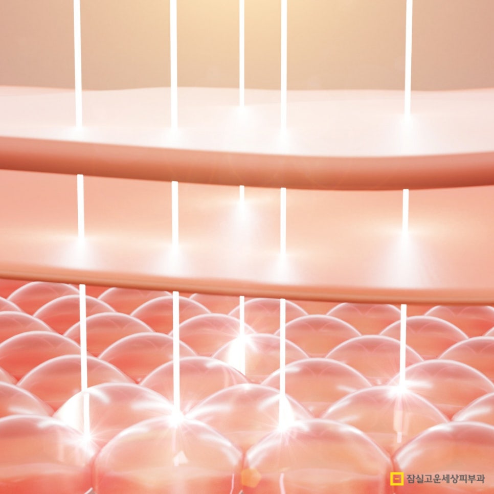 사마귀, 검버섯, 흑자 구분법 및 치료 가이드 관련 이미지 9