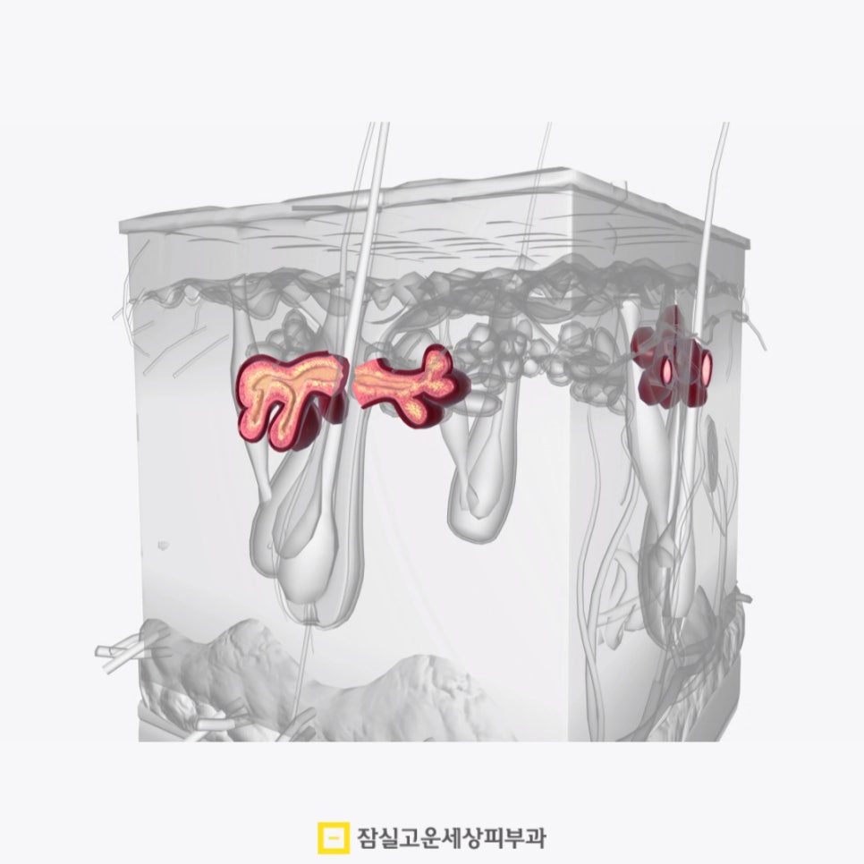 환절기 건조한 피부, 각질 관리 팁 관련 이미지 3