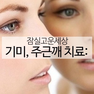 기미, 주근깨 제거엔 레블라이트! (기미잡티제거/잠실역피부과/잠실피부과전문의) 관련 이미지 3