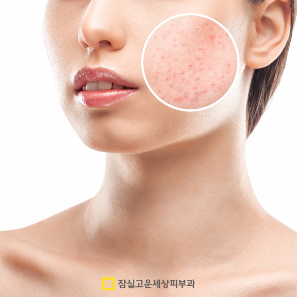 피부가 뒤집힐 땐 이유가 있습니다. 관련 이미지 2