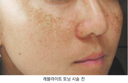 피부나이측정 집에서 하기! 2016 새해 피부나이 이제 그만 먹자! 관련 이미지 4