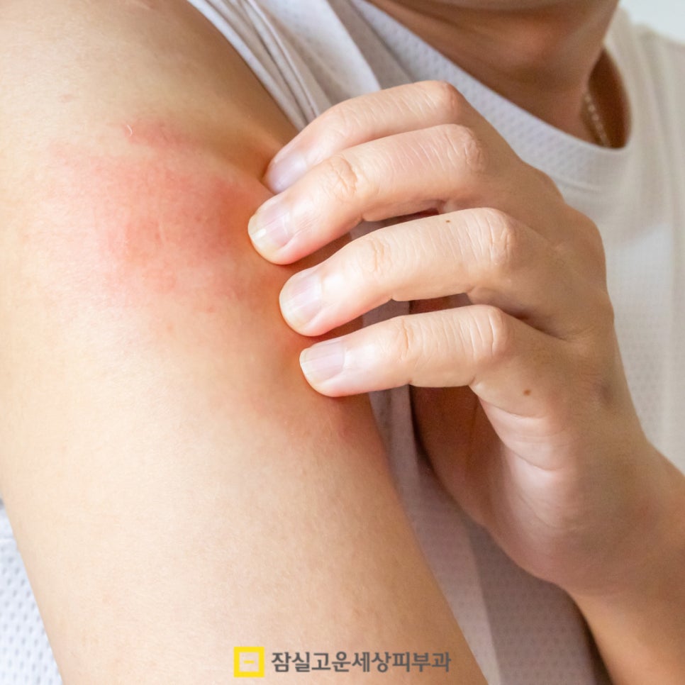 피부 건조, 원인부터 관리까지 알아보기 관련 이미지 18