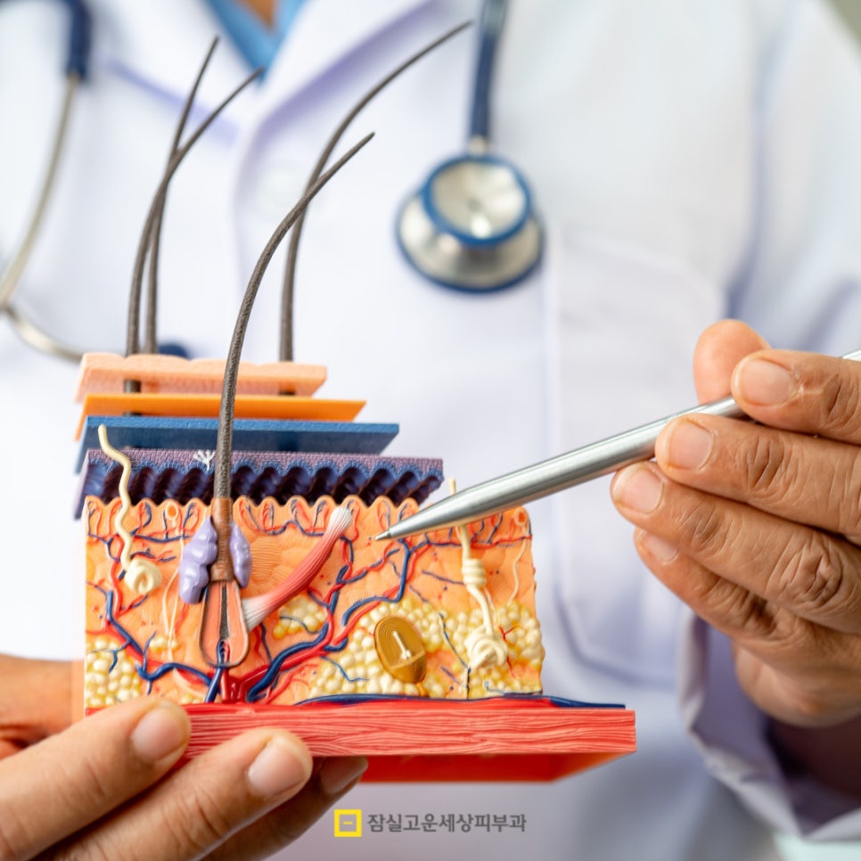 아토피 피부염 완전 가이드 관련 이미지 3