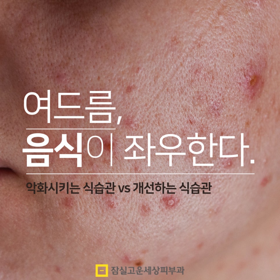 [잠실고운세상피부과] 여드름, &lsquo;음식&rsquo;이 좌우한다. 관련 이미지 1