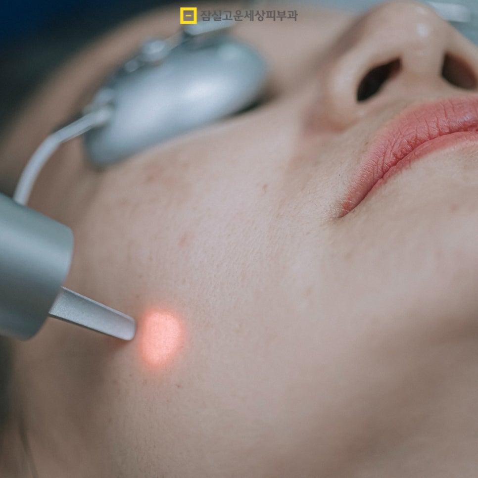 여드름 완전 정복, 원인부터 치료까지 관련 이미지 4