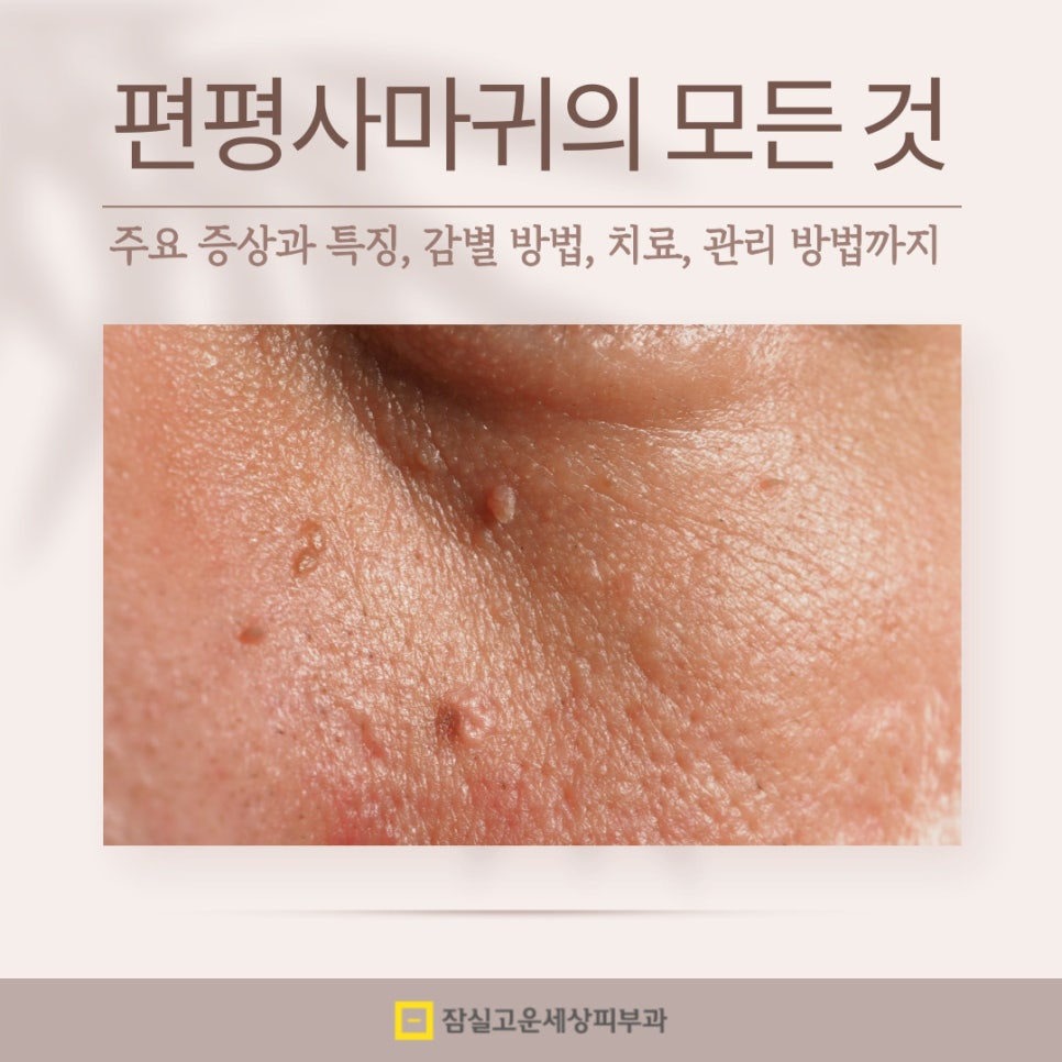 피부에 나타나는 작은 돌기, 편평사마귀에 대해 알아야 할 모든 것 관련 이미지 1