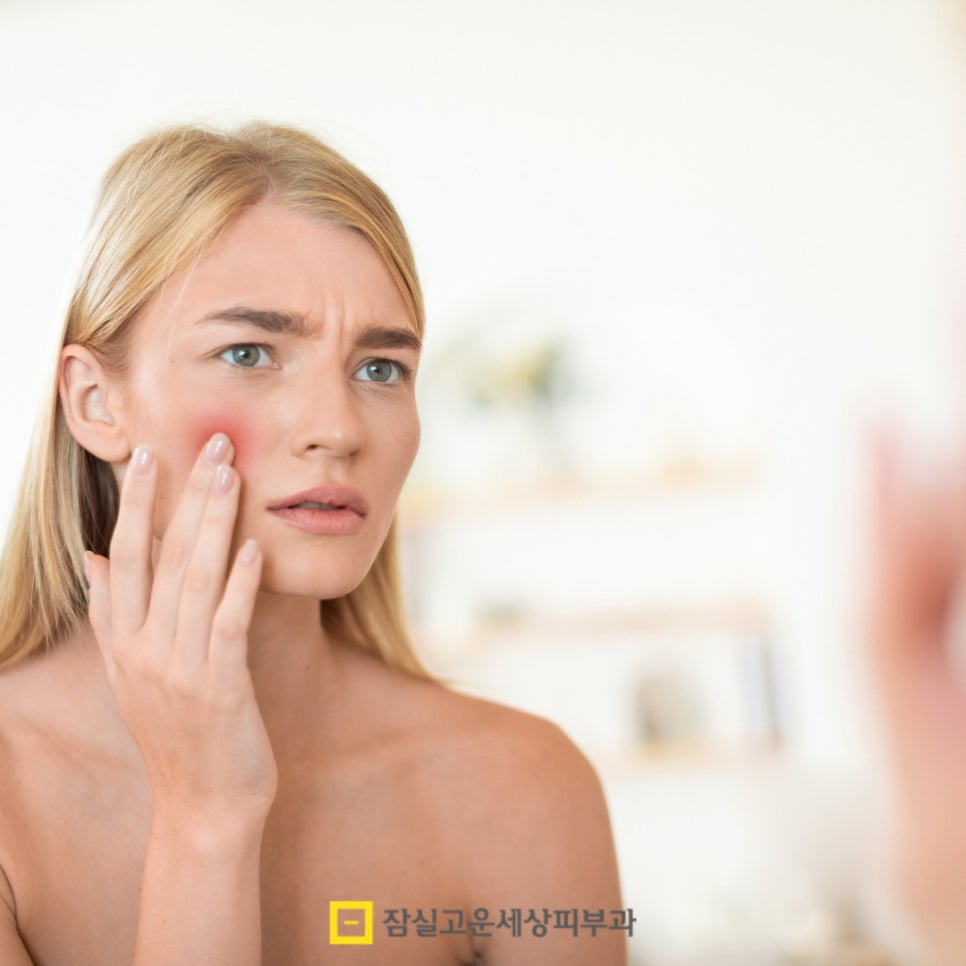 여드름 약, 복용 전 꼭 알아야 할 5가지 핵심 포인트 관련 이미지 8