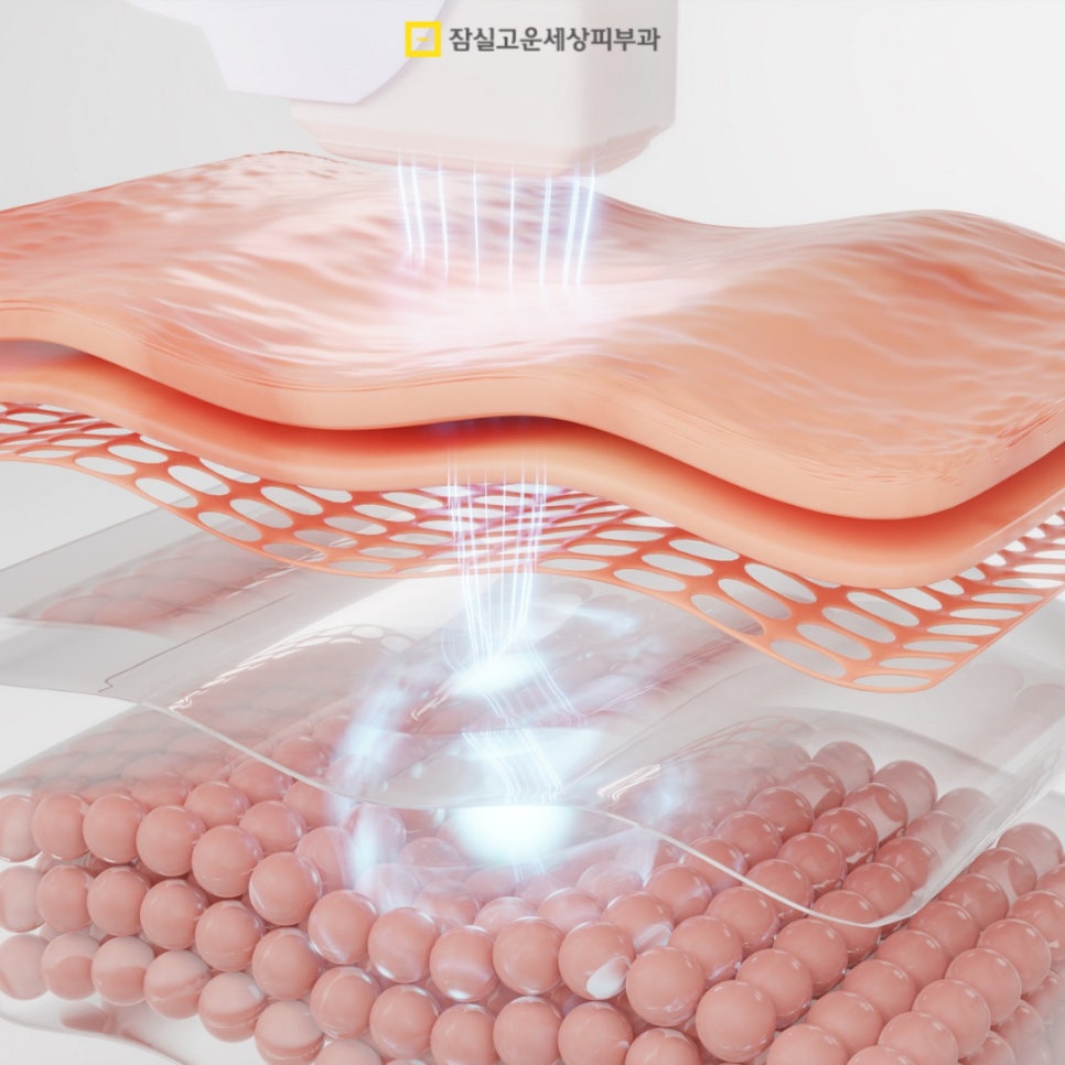 피부관리정보, 무더위에도 빛나는 맑은 피부를 위한 실전 가이드 관련 이미지 7