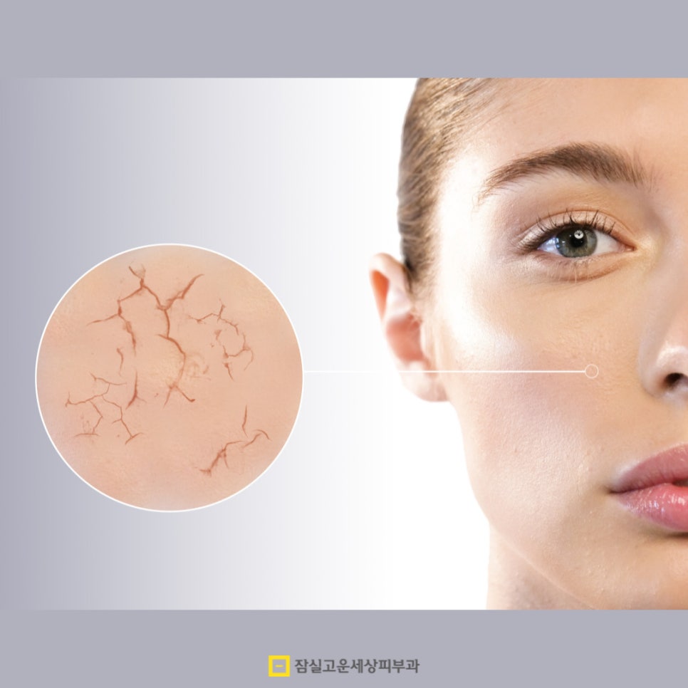 피부가 건조하다는 건 정확히 어떤 상태를 말하나요? 관련 이미지 8