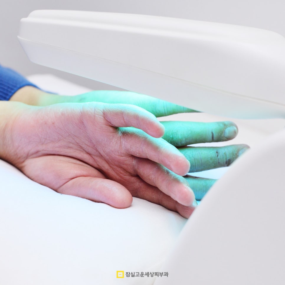 아토피 피부염, 일상에서 지키는 4가지 핵심 관리법 관련 이미지 6