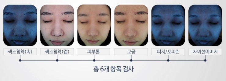 잠실고운세상의 피부정밀측정기 야누스 (잠실피부과추천/피부진단기) 관련 이미지 3