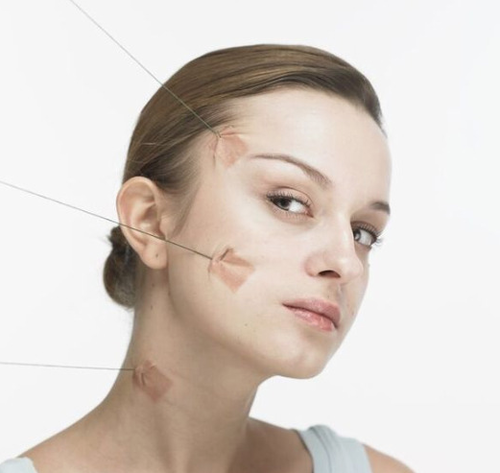 써마지CPT 처진얼굴에 탄력과 브이라인을 함께! (리프팅/잠실고운세상) 관련 이미지 1