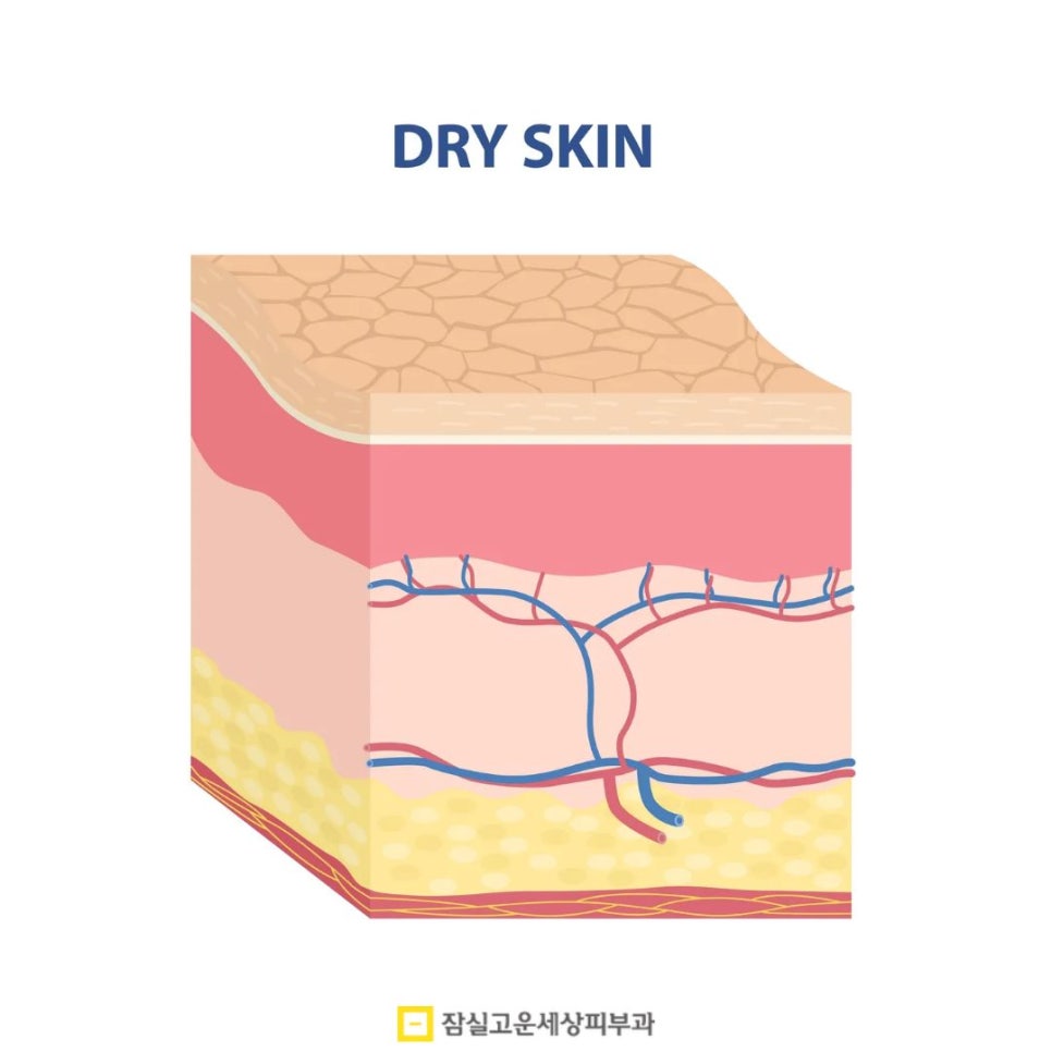 건조한데 기름지는 피부? 손건조부터 장벽까지, 타입별 진단 가이드 관련 이미지 3