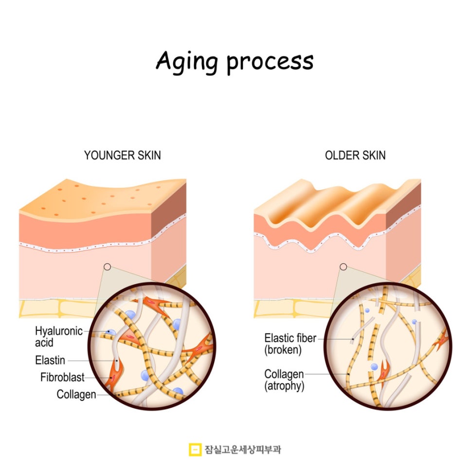 피부 노화 방지를 위한 5가지 핵심 관리법 관련 이미지 2