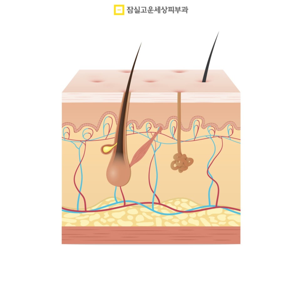 여드름 완전 정복, 원인부터 치료까지 관련 이미지 2