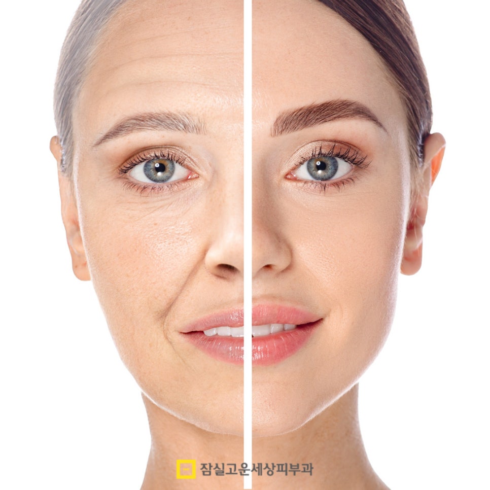 탄력 있는 피부, 나이가 들수록 더 &lsquo;관리해야&rsquo; 지켜집니다 관련 이미지 2