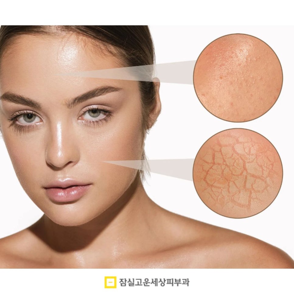 속건조, 수분크림만으론 안되는 피부의 구조적 문제 관련 이미지 3