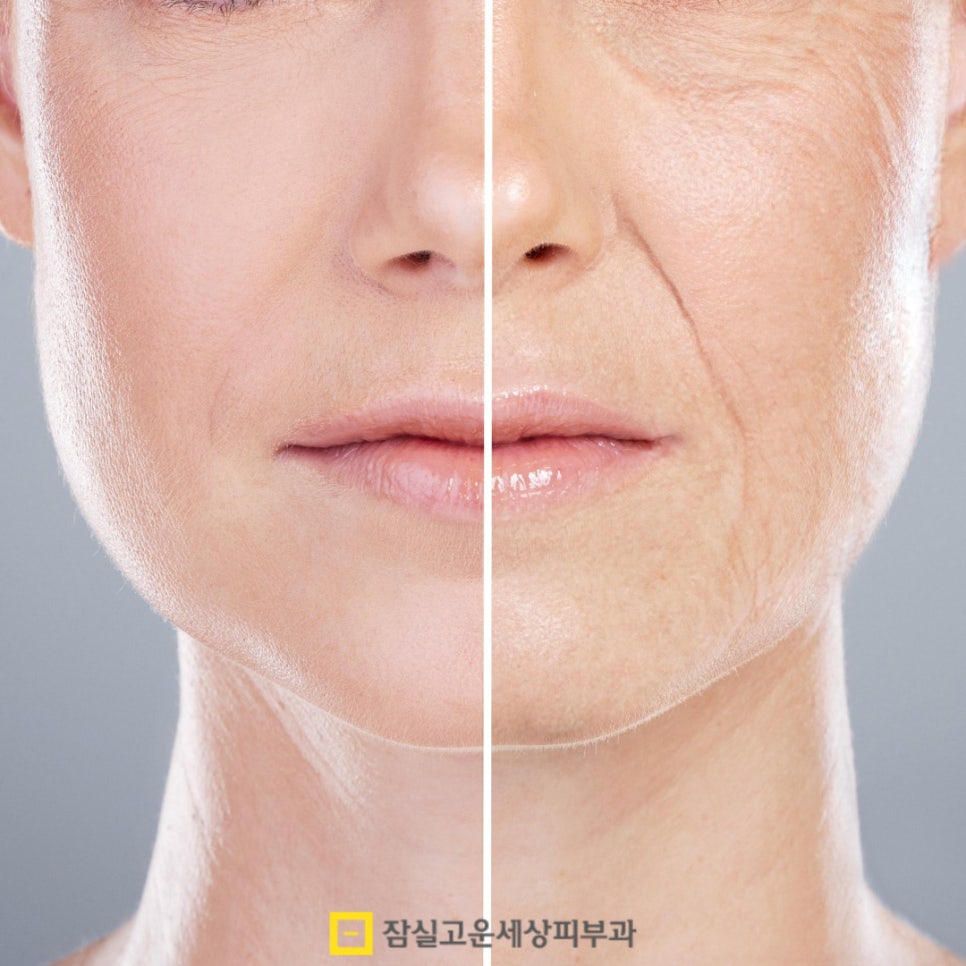 환절기에 더 심해지는 피부 건조, 어떻게 관리해야 할까? 관련 이미지 4