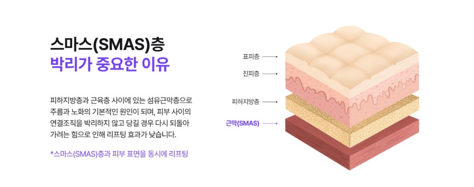목거상술비용만 확인하면 안 되는 이유 관련 이미지 6