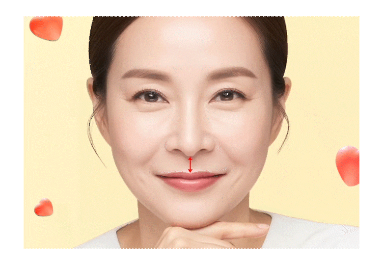 인중축소수술후기로 보는 얼굴 중심 비율의 재조정 ｜ 신사리프팅성형외과의 섬세한 접근 관련 이미지 13