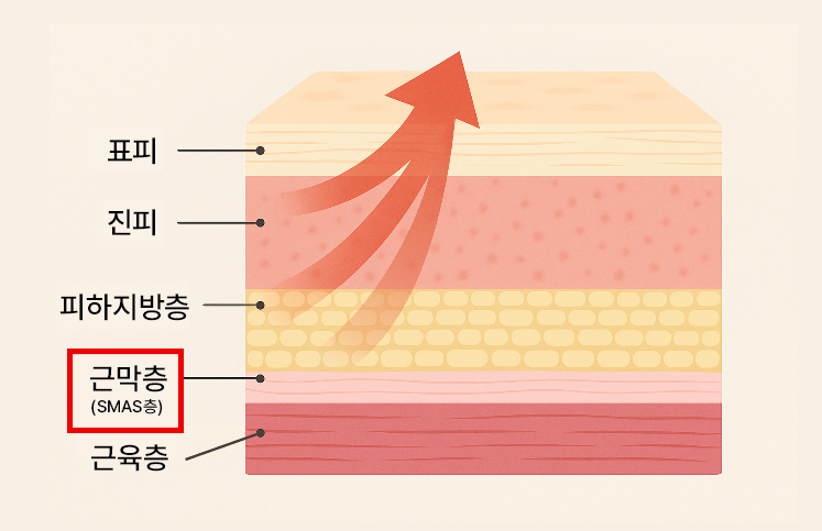 Why Is Mini Facelift Recovery Time in Gangnam Plastic Surgery Possible Over the Weekend? image 8