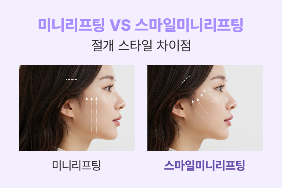 Key Guide to Choosing a Mini Facelift Lifting Plastic Surgery Clinic! (Natural Improvement of Facial Contours in Summer) image 8
