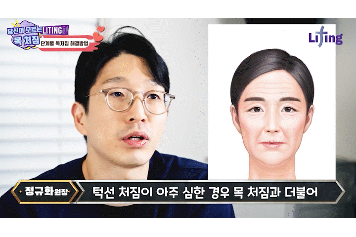 턱선리프팅 리팅미니리프팅 정보 (여름에 시너지나는 리프팅) 관련 이미지 13