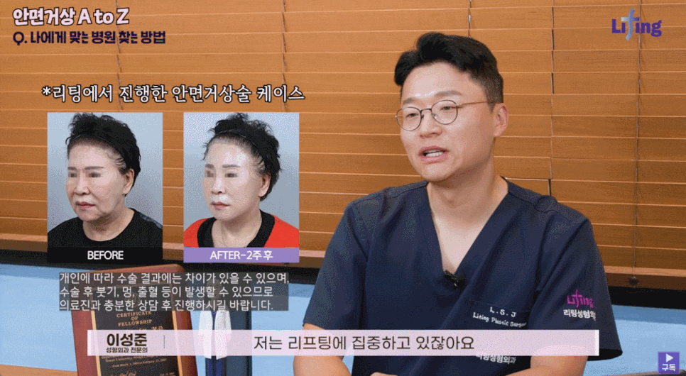 Seoul Gangnam Plastic Surgery: The Lifting Approach Explained by a Facelift Surgeon image 4