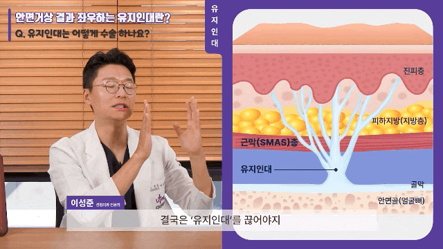 Facelift Surgery at Liting Plastic Surgery, a Medical Institution Focused on Lifting image 2