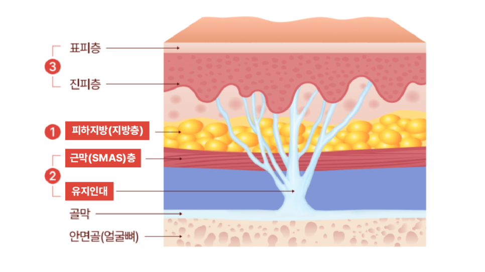 뼈 절제 없이 얼굴선 정돈, 안면윤곽수술의 또 다른 해석 | 리팅미니윤곽술 관련 이미지 18