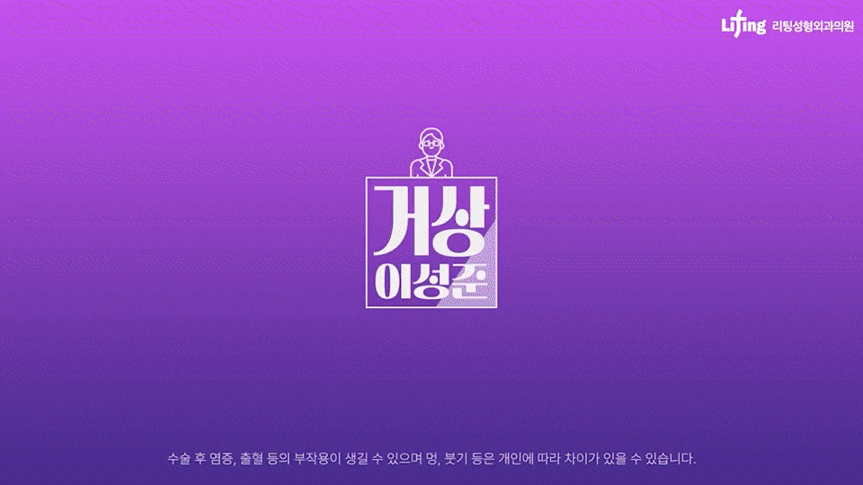 강남미니거상, 왜 안면거상성형외과에서도 주목할까? 관련 이미지 1