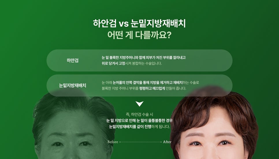 하안검수술흉터 연고, 울퉁불퉁한 눈 밑 흉터 걱정 없이 개선하는 방법 관련 이미지 2