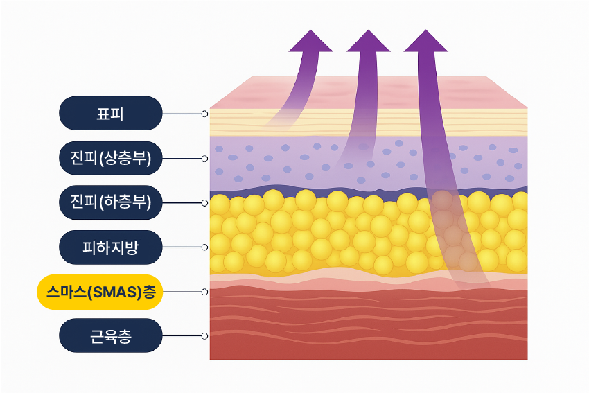 팔자주름수술 필러로는 부족할 때 미니리프팅가격도 체크해보세요 관련 이미지 14