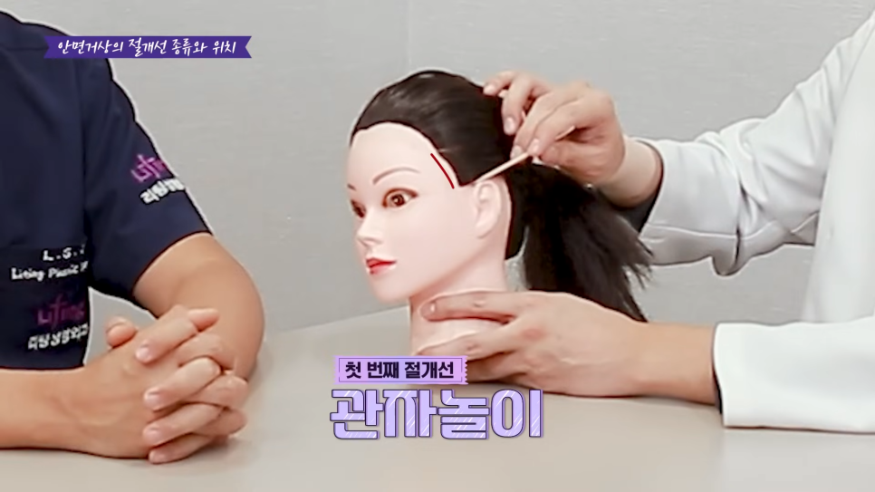 A Story That People Worried About Facelift Scars in Sinsa Station Plastic Surgery Should Definitely Read image 12