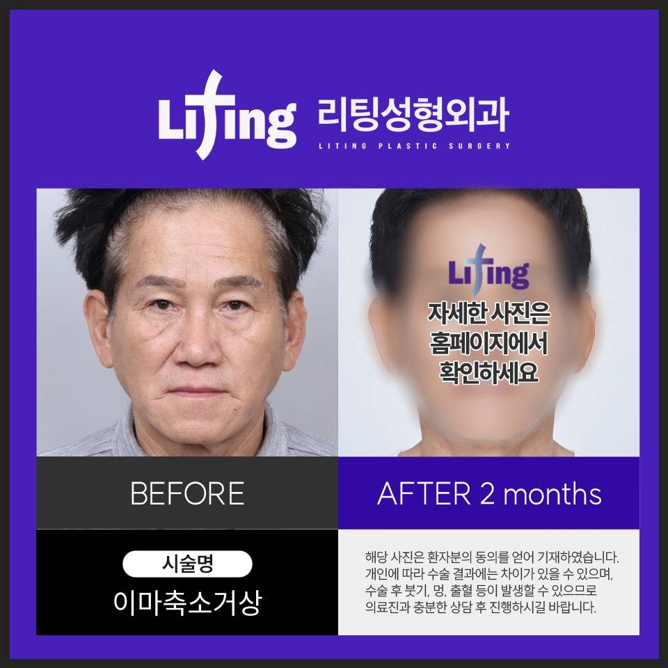 내시경 이마거상술 가격을 알아보고 계신다면 주목하세요! 관련 이미지 5