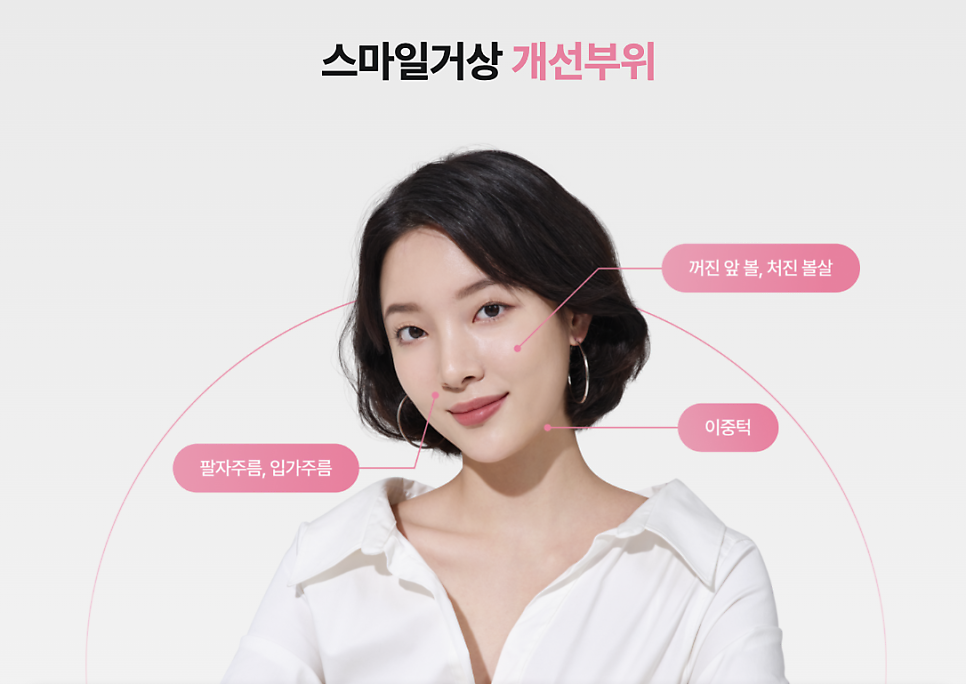 강남역성형외과 스마일거상 볼륨까지 살리는 반거상 리프팅의 핵심은? 관련 이미지 11