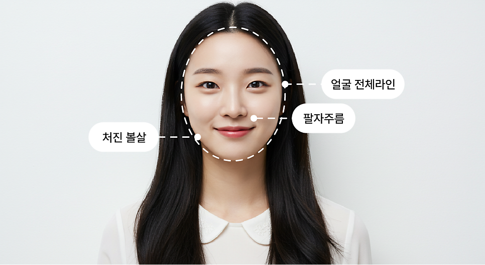 스마일리프팅가격 궁금하다면? 스마일거상과의 차이까지 한번에 정리 관련 이미지 5