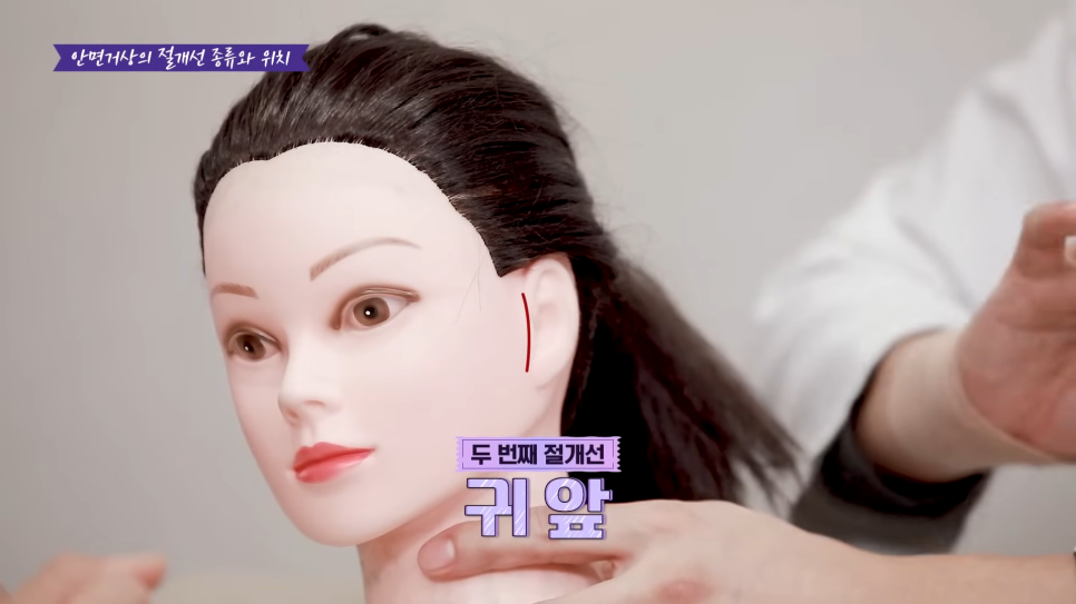 A Story That People Worried About Facelift Scars in Sinsa Station Plastic Surgery Should Definitely Read image 13