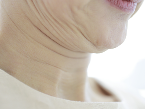 서울실리프팅? 안면거상? 30대 이상은 무조건 필독하세요 <✨LITING TALK✨> 관련 이미지 5