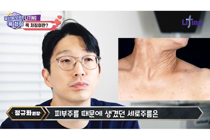 얼굴실리프팅 목주름보톡스, 목주름 솔루션 여름이 타이밍! 관련 이미지 6