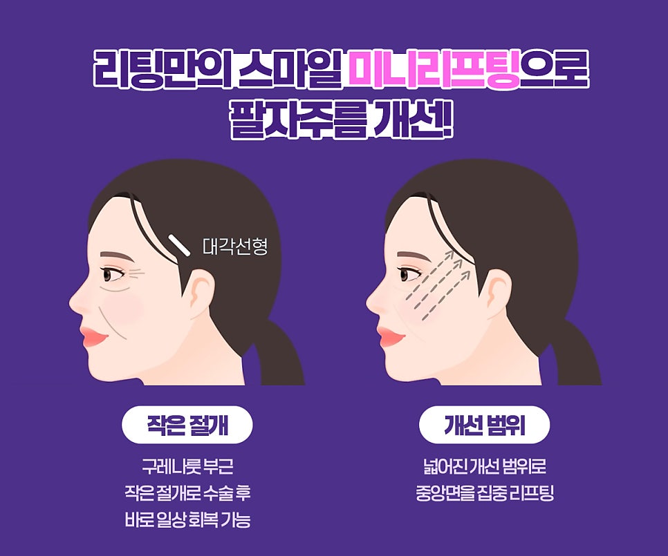 팔자주름 개선 얼굴주름리프팅으로 시술 비용 줄이기 관련 이미지 7