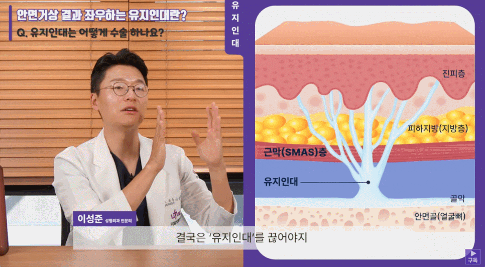 중년리프팅 오래가는 강력한 리프팅 관련 이미지 5