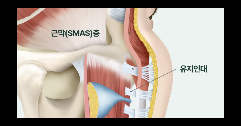 일산성형외과 안면거상후기 얼굴은 팽팽해졌는데, 왜 목주름이 더 눈에 띄는 걸까요? 관련 이미지 10