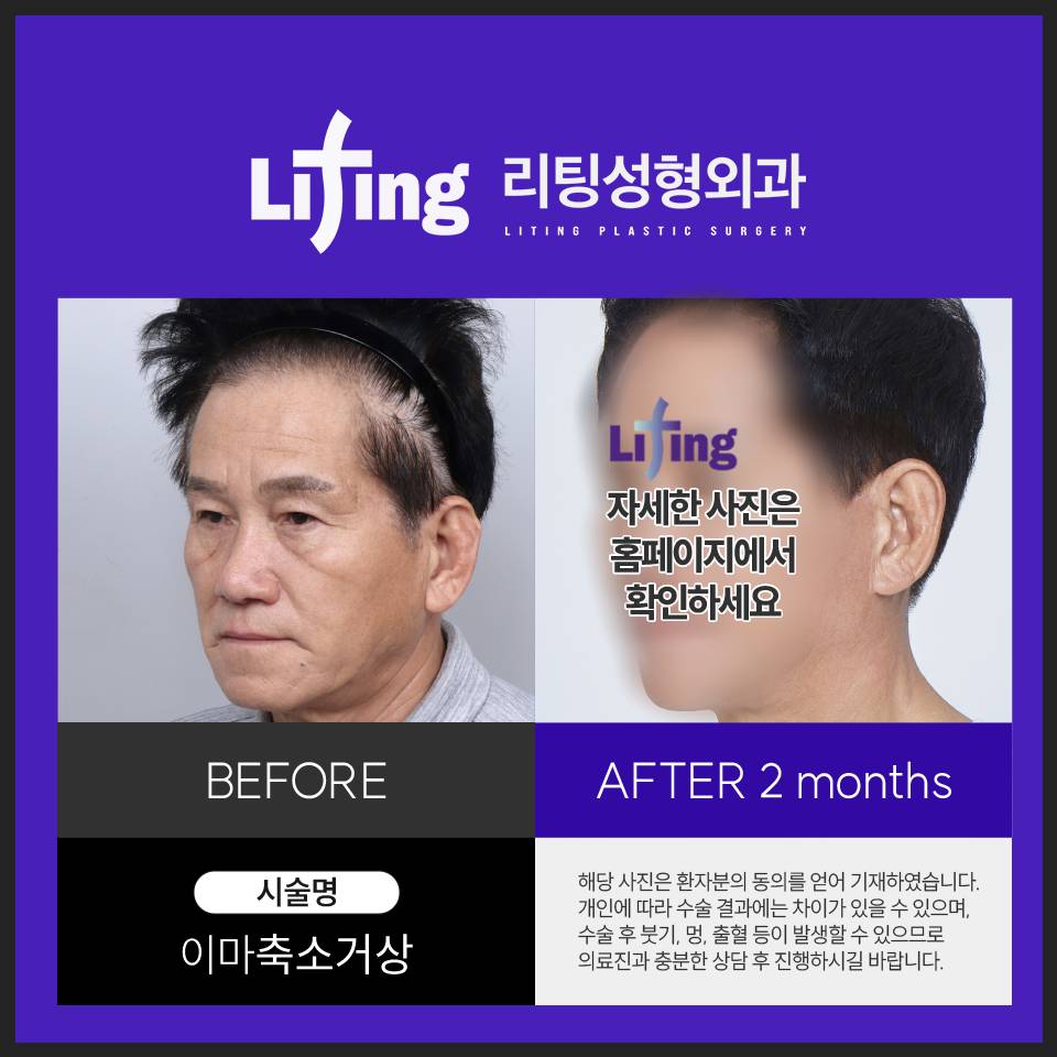 이마거상술효과? 궁금하신 분들만 <클릭> 관련 이미지 7