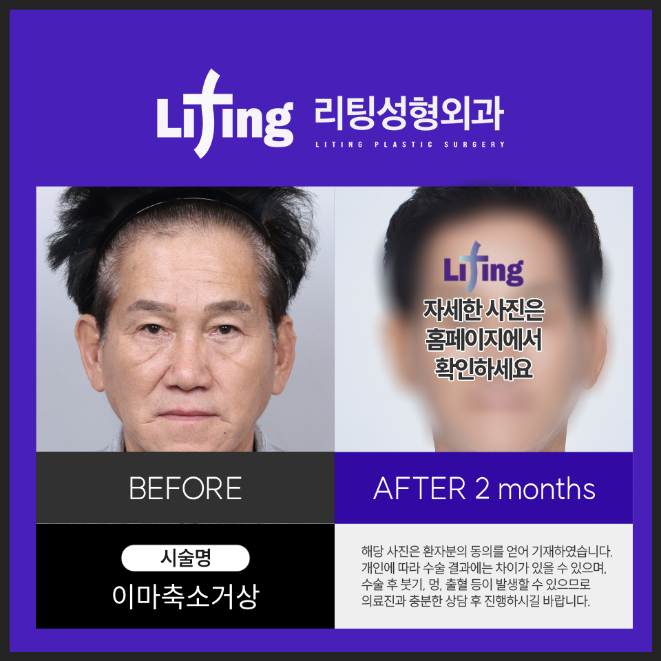 이마거상 전후로 알아보는 성공적인 결과를 얻기 위한 <포인트> 관련 이미지 5