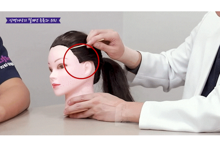 신사역리팅 안면거상술가격 차이, 비용보다 매우 중요한 건 ‘이것?’ 관련 이미지 7