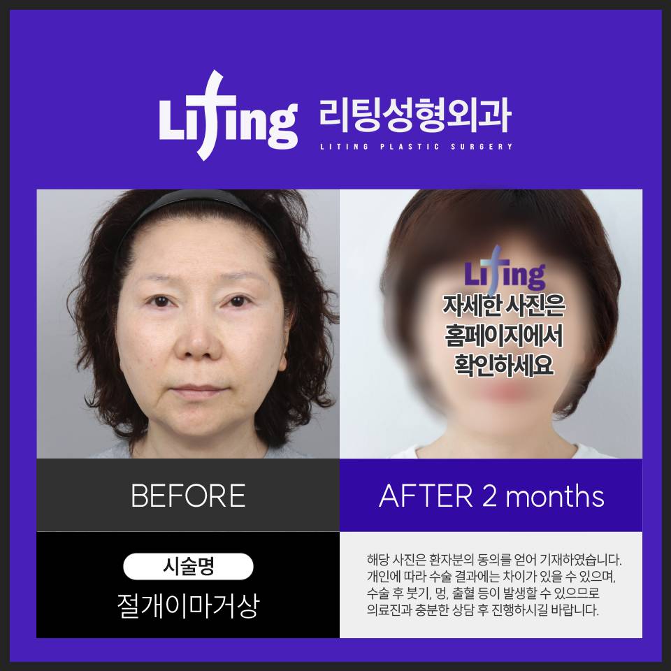 이마거상술효과? 궁금하신 분들만 <클릭> 관련 이미지 10
